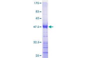 Image no. 1 for Ribosomal Protein L17 (RPL17) (AA 1-184) protein (GST tag) (ABIN1318556)