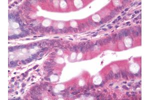 Immunohistochemistry (IHC) image for anti-ATPase, Cu++ Transporting, beta Polypeptide (ATP7B) (AA 3-21) antibody (ABIN1948315)