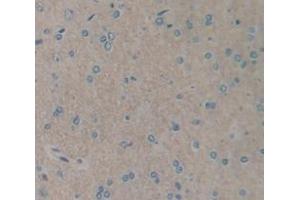 IHC-P analysis of Rat Tissue, with DAB staining. (IL1R1 antibody  (AA 386-553))
