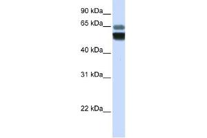 SMPD1 antibody used at 1 ug/ml to detect target protein.