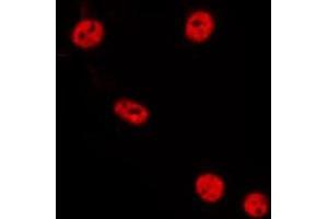 ABIN6275549 staining HepG2 by IF/ICC. (PPP2R3B antibody  (Internal Region))
