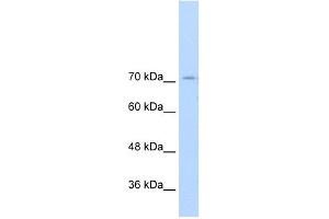 WB Suggested Anti-GTF2IRD1 Antibody Titration:  2. (GTF2IRD1 antibody  (N-Term))