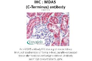 Image no. 2 for anti-Interferon Induced with Helicase C Domain 1 (IFIH1) antibody (ABIN1736854) (IFIH1 antibody)