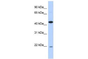 Western Blotting (WB) image for anti-RNA-Binding Protein NOB1 (NOB1) antibody (ABIN2459838) (NOB1 antibody)