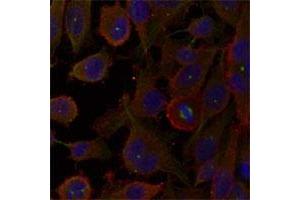 Immunofluorescence staining of methanol-fixed HeLa cells using MAP1LC3A polyclonal antibody . (MAP1LC3A antibody)