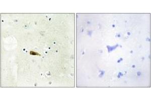Immunohistochemistry analysis of paraffin-embedded human brain tissue, using MYST1 Antibody.