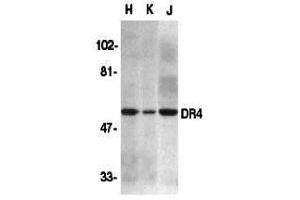 Western Blotting (WB) image for anti-Drought-Repressed 4 Protein (DR4) (N-Term) antibody (ABIN1031359) (DR4 antibody  (N-Term))