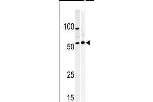 Western blot analysis of anti-PKMYT1 Pabin A375(left) and Y79 (right)cell line lysate. (MYT1 antibody  (C-Term))