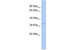 GNB1 antibody used at 1 ug/ml to detect target protein.