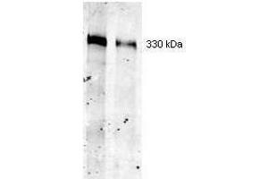 Western blot using ROCKLAND Immunochemical's Mouse Mab-anti-Thyroglobulin antibody. (Thyroglobulin antibody)