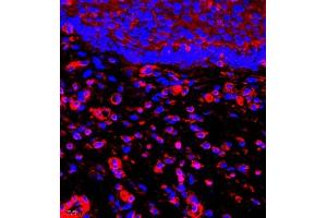 Immunofluorescence of paraffin embedded human esophagus using MYL6 (ABIN7074734) at dilution of 1:650 (400x lens) (MYL6 antibody)