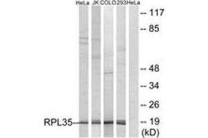 Western blot analysis of extracts from 293/HeLa/COLO/Jurkat cells, using RPL35 Antibody.