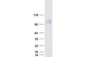 Western Blotting (WB) image for Core-binding Factor, Runt Domain, alpha Subunit 2, Translocated To, 2 (CBFA2T2) (Transcript Variant 4) protein (Myc-DYKDDDDK Tag) (ABIN2713251)