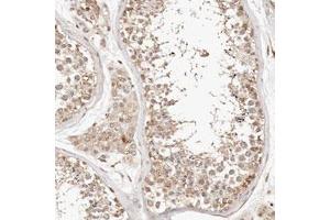 Immunohistochemical staining (Formalin-fixed paraffin-embedded sections) of human testis with KIF9 polyclonal antibody  shows moderate cytoplasmic positivity in cells in seminiferous ducts and Leydig cells. (KIF9 antibody)