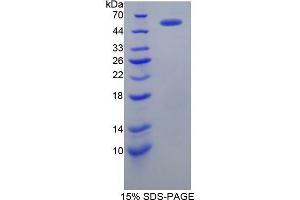 SDS-PAGE (SDS) image for Fibrinogen beta Chain (FGB) (AA 29-491) protein (His tag) (ABIN1079527) (Fibrinogen beta Chain Protein (FGB) (AA 29-491) (His tag))