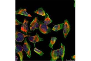 Image no. 2 for anti-Nuclear Factor of kappa Light Polypeptide Gene Enhancer in B-Cells 2 (NFKB2) (AA 864-868) antibody (ABIN197118)