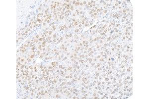 Immunohistochemistry (IHC) image for anti-Runt-Related Transcription Factor 2 (RUNX2) (AA 300-350) antibody (ABIN7795797) (Recombinant RUNX2 antibody  (AA 300-350))