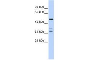 Image no. 1 for anti-HtrA Serine Peptidase 4 (HTRA4) (AA 396-445) antibody (ABIN6741359) (HTRA4 antibody  (AA 396-445))
