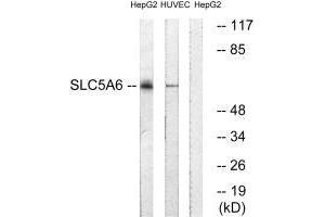 Western blot analysis of extracts from HepG2 cells and HUVEC cells, using SLC5A6 antibody. (SLC5A6 antibody)