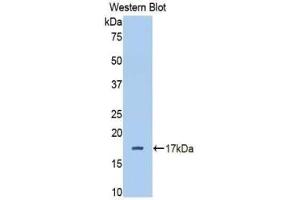 Western blot analysis of the recombinant protein. (Complement Factor B antibody  (AA 477-600))