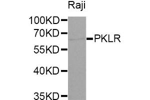 Western blot analysis of extracts of Raji cells, using PKLR antibody (ABIN5970989) at 1/1000 dilution. (PKLR antibody)