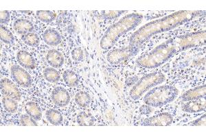 Detection of Hsp60 in Human Small intestine Tissue using Polyclonal Antibody to Heat Shock Protein 60 (Hsp60) (HSPD1 antibody  (AA 1-573))