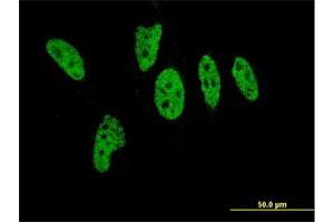Immunofluorescence of monoclonal antibody to EP300 on HeLa cell. (p300 antibody  (AA 731-830))