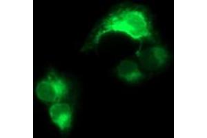 Image no. 3 for anti-CD163 (CD163) antibody (ABIN1497175) (CD163 antibody)