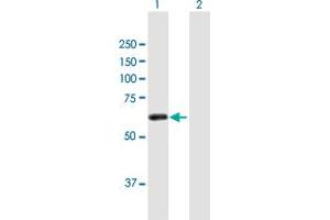 Western Blot analysis of ZSCAN21 expression in transfected 293T cell line by ZSCAN21 MaxPab polyclonal antibody. (ZSCAN21 antibody  (AA 1-473))