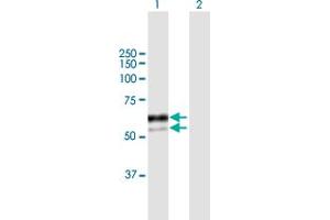 Western Blot analysis of SNX8 expression in transfected 293T cell line by SNX8 MaxPab polyclonal antibody. (SNX8 antibody  (AA 1-465))