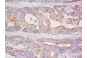 ADAMTSL4 antibody  (AA 351-450)