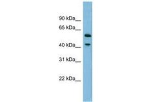 Image no. 1 for anti-Dihydrouridine Synthase 1-Like (DUS1L) (AA 359-408) antibody (ABIN6745180) (DUS1L antibody  (AA 359-408))