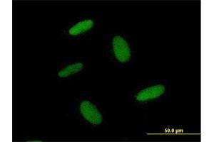 Immunofluorescence of purified MaxPab antibody to ZNF557 on HepG2 cell. (ZNF557 antibody  (AA 1-375))