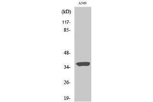Western Blotting (WB) image for anti-Six Transmembrane Epithelial Antigen of The Prostate 1 (STEAP1) (N-Term) antibody (ABIN3187095) (STEAP1 antibody  (N-Term))