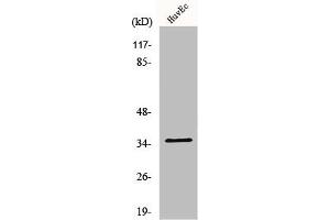 Western Blot analysis of Jurkat cells using Nanog P8 Polyclonal Antibody (NANOGP8 antibody  (Internal Region))