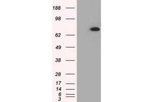 HEK293T cells were transfected with the pCMV6-ENTRY control (Left lane) or pCMV6-ENTRY PDE4A (Right lane) cDNA for 48 hrs and lysed. (PDE4A antibody)