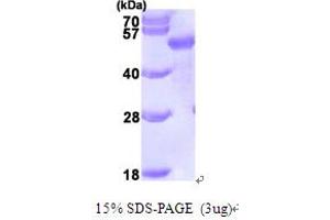 SDS-PAGE (SDS) image for Sequestosome 1 (SQSTM1) (AA 1-356) protein (His tag) (ABIN666979)