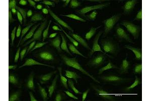 Immunofluorescence of monoclonal antibody to DEAF1 on HeLa cell. (DEAF1 antibody  (AA 133-222))