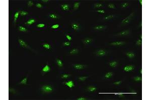 Immunofluorescence of purified MaxPab antibody to RRS1 on HeLa cell. (RRS1 antibody  (AA 1-365))