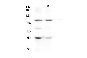 Western blot analysis of DPYD using anti-DPYD antibody . (DPYD antibody  (AA 356-511))