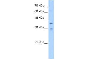 Western Blotting (WB) image for anti-Transmembrane Protein 104 (TMEM104) antibody (ABIN2463056) (TMEM104 antibody)