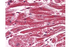 Anti-VEGFR-1 antibody IHC of human heart. (FLT1 antibody  (AA 1251-1338))