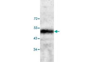 Western blot analysis of human fetal heart tissue lysate with CNN3 polyclonal antibody  at 1:200 dilution.