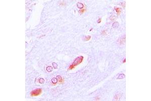 Immunohistochemical analysis of GRP94 staining in human brain formalin fixed paraffin embedded tissue section. (GRP94 antibody  (C-Term))