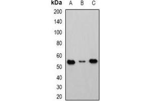 Western blot analysis of Cbl-3 expression in HEK293T (A), Raji (B), mouse kidney (C) whole cell lysates.