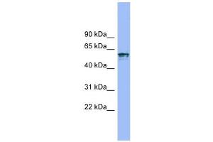 IL18R1 antibody used at 1 ug/ml to detect target protein. (IL18R1 antibody  (N-Term))