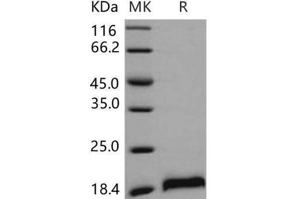 CDNF Protein (His tag)