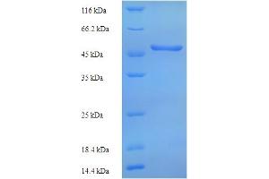 SDS-PAGE (SDS) image for Tryptophan 2,3-Dioxygenase (TDO2) (AA 1-406), (full length) protein (His tag) (ABIN5713878) (TDO2 Protein (AA 1-406, full length) (His tag))