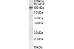 Western Blotting (WB) image for anti-Taste Receptor, Type 1, Member 2 (TAS1R2) (Internal Region) antibody (ABIN2465782) (TAS1R2 antibody  (Internal Region))