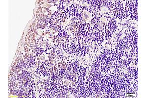 Immunohistochemistry (IHC) image for anti-Interferon Regulatory Factor 7 (IRF7) (pSer471), (pSer472) antibody (ABIN742703)